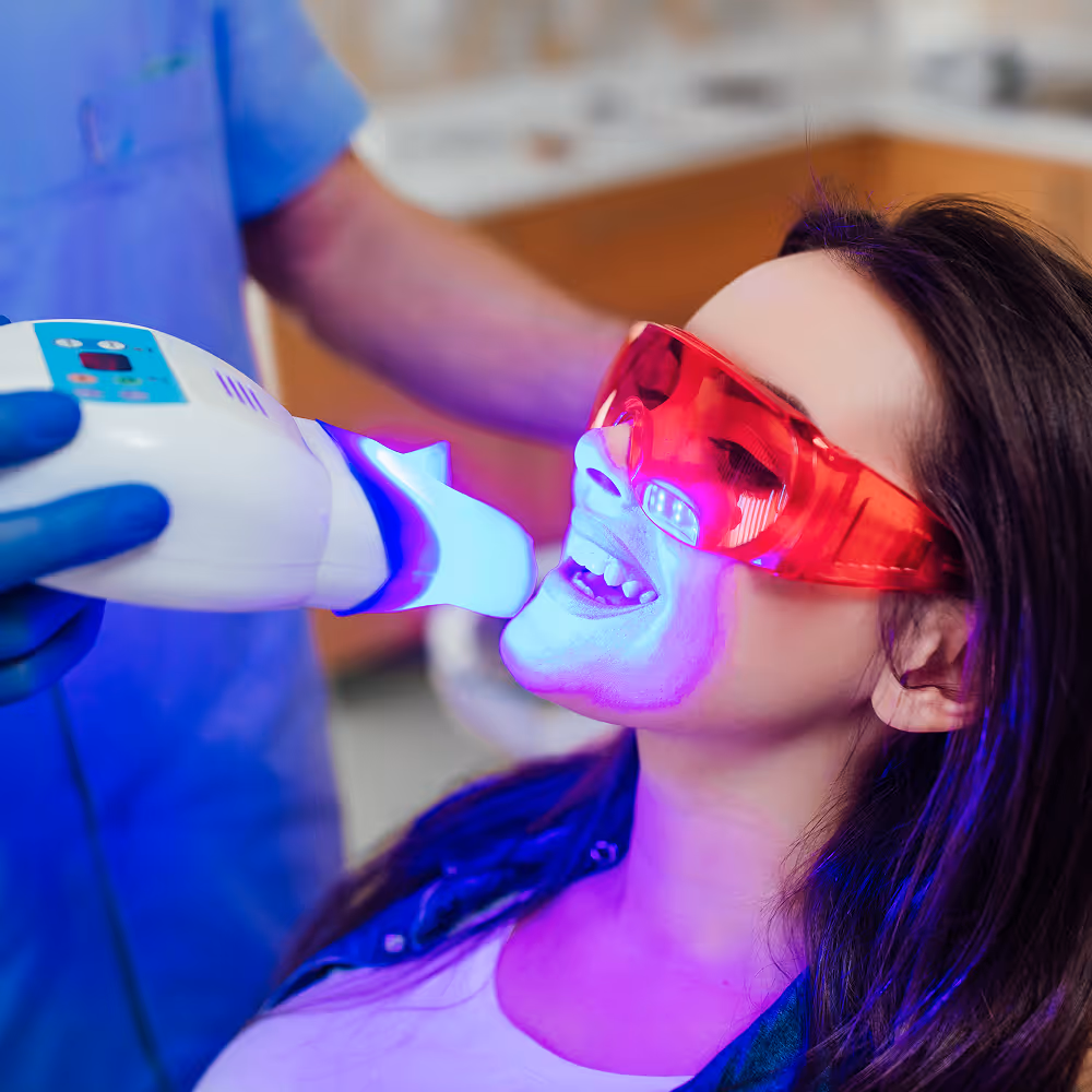 Professional teeth whitening treatment for a brighter smile at Marvel Dental in Clifton NJ
