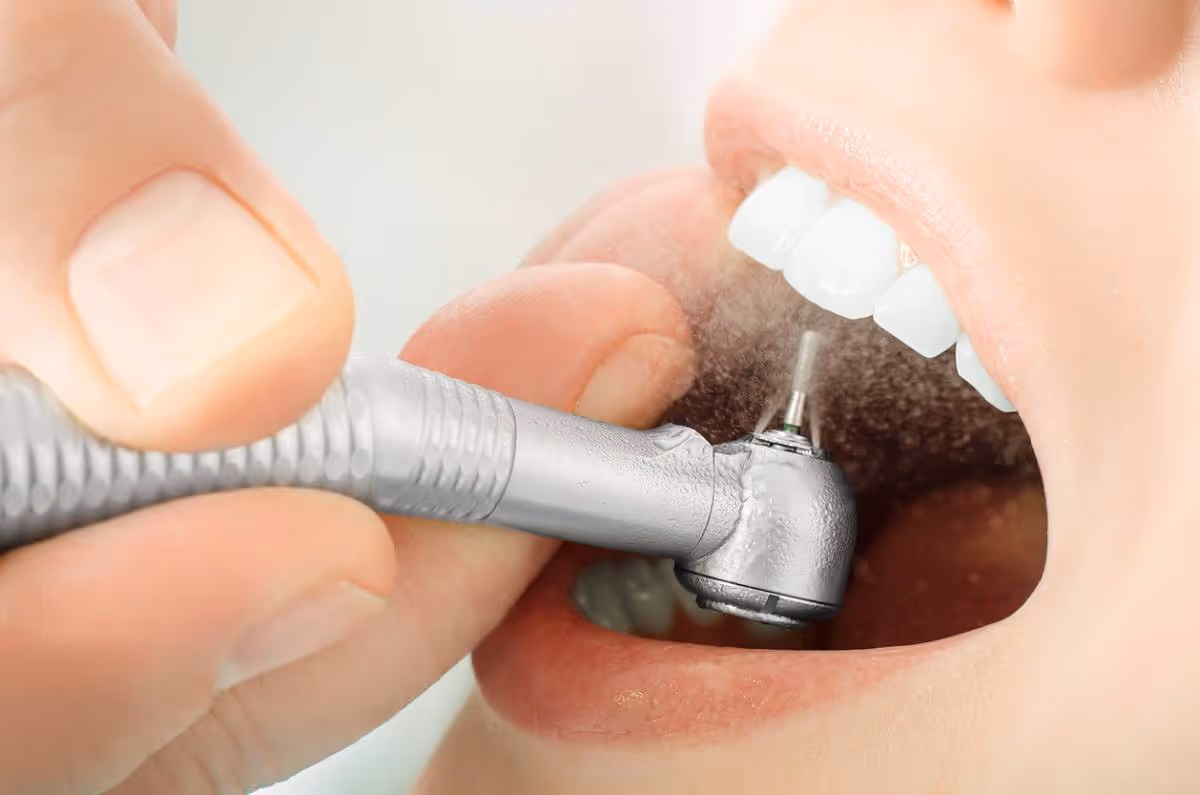Dentist removing tooth stains with polishing and cleaning treatment