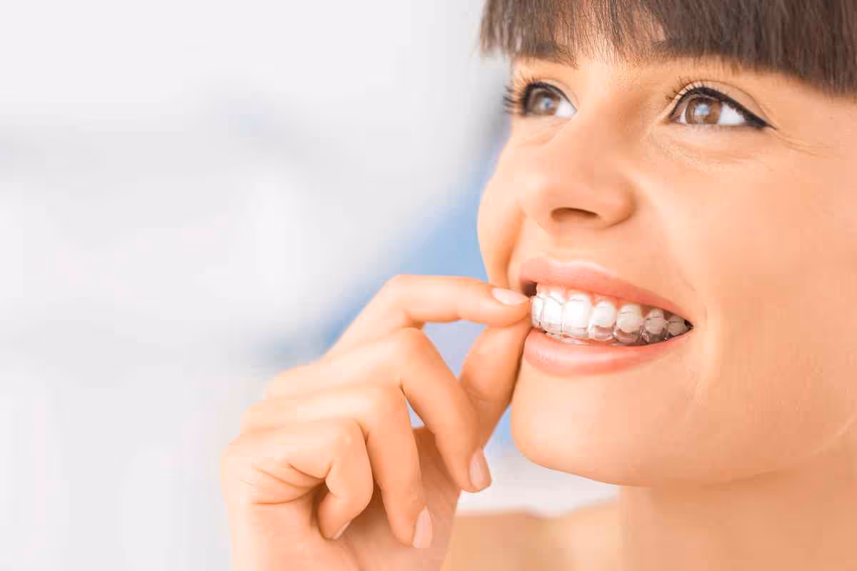 Patient wearing clear aligners to gradually straighten teeth