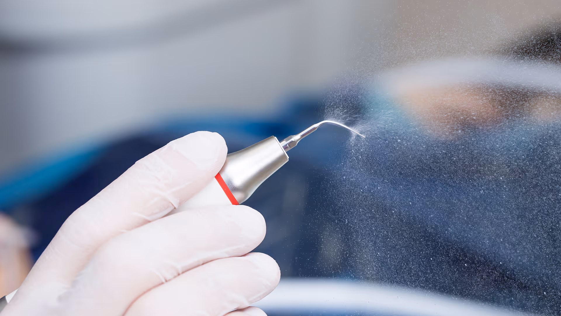Professional dental stain removal treatment at Marvel Dental in Clifton NJ