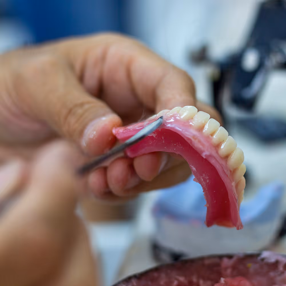 Full mouth dental implants in Clifton NJ at Marvel Dental