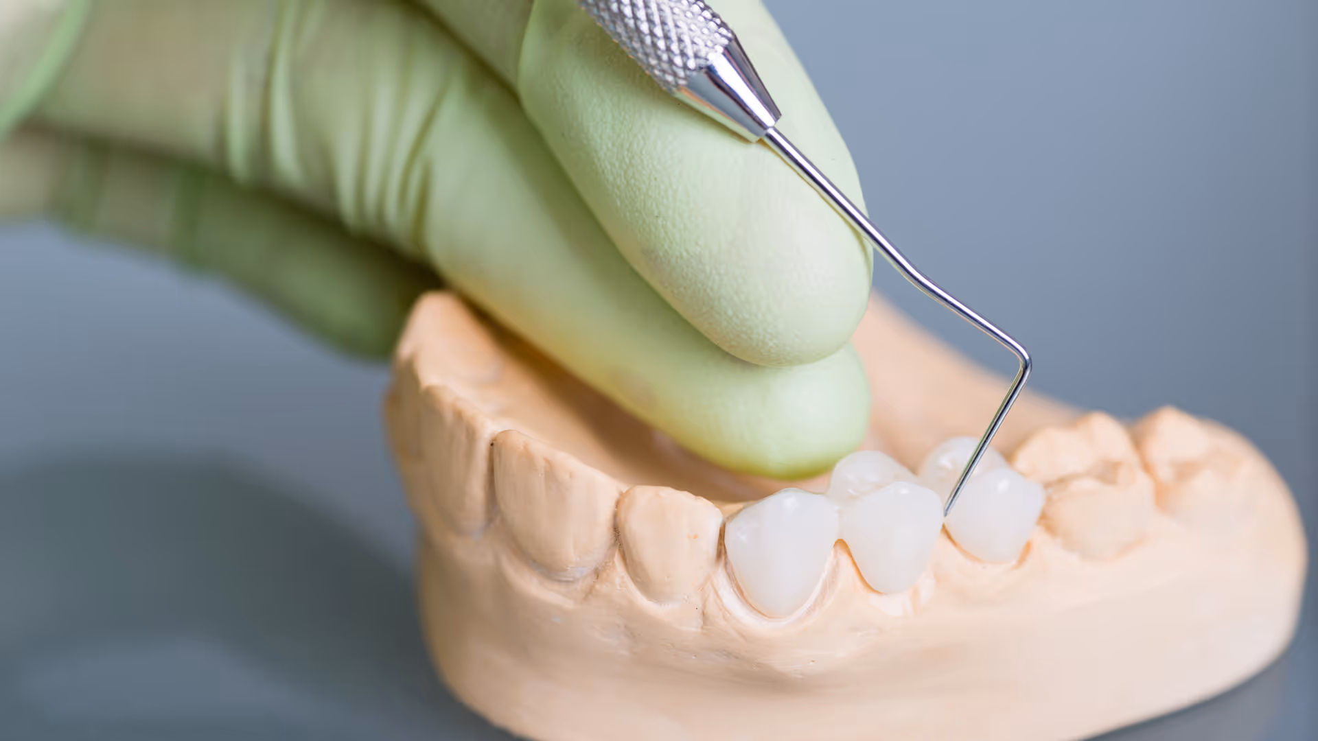 Dental bridge treatment in Clifton NJ