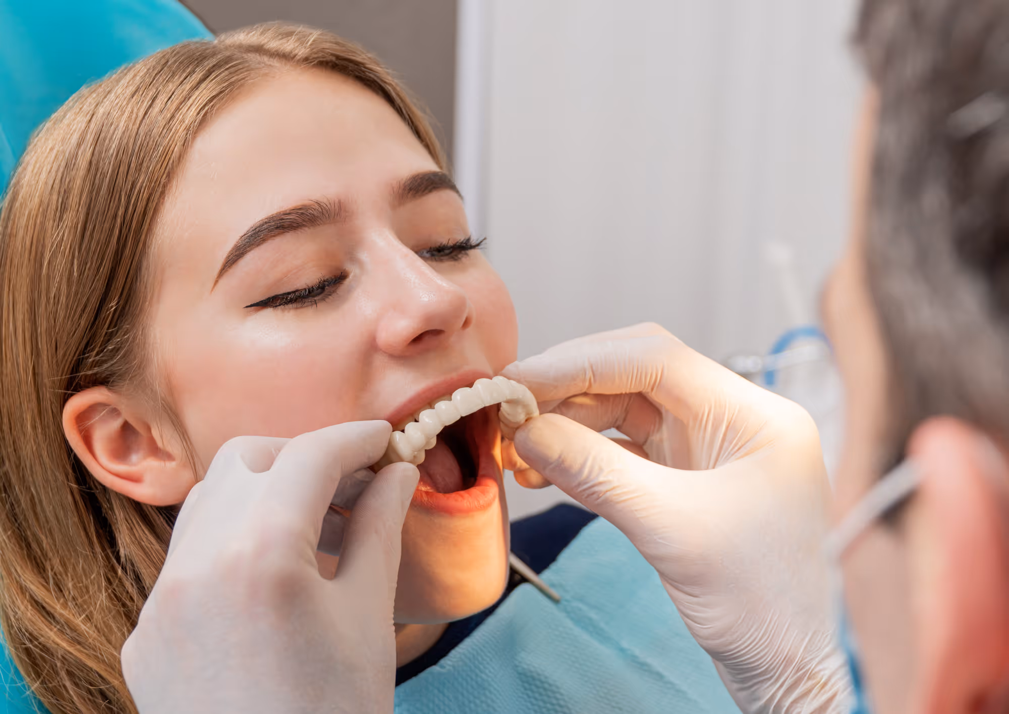 What is a full mouth dental prosthesis and how it restores teeth