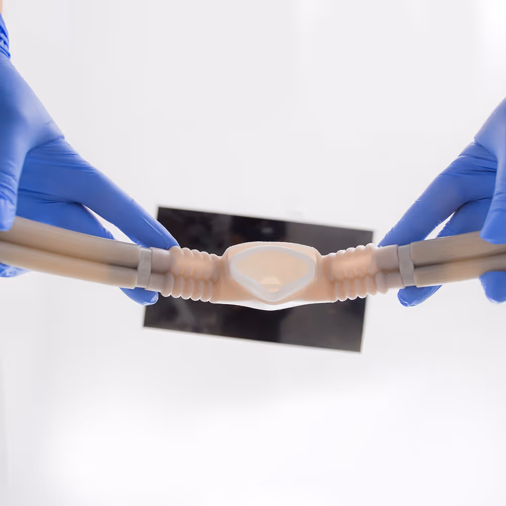 Dental sedation procedure using nitrous oxide mask to keep patient calm and comfortable