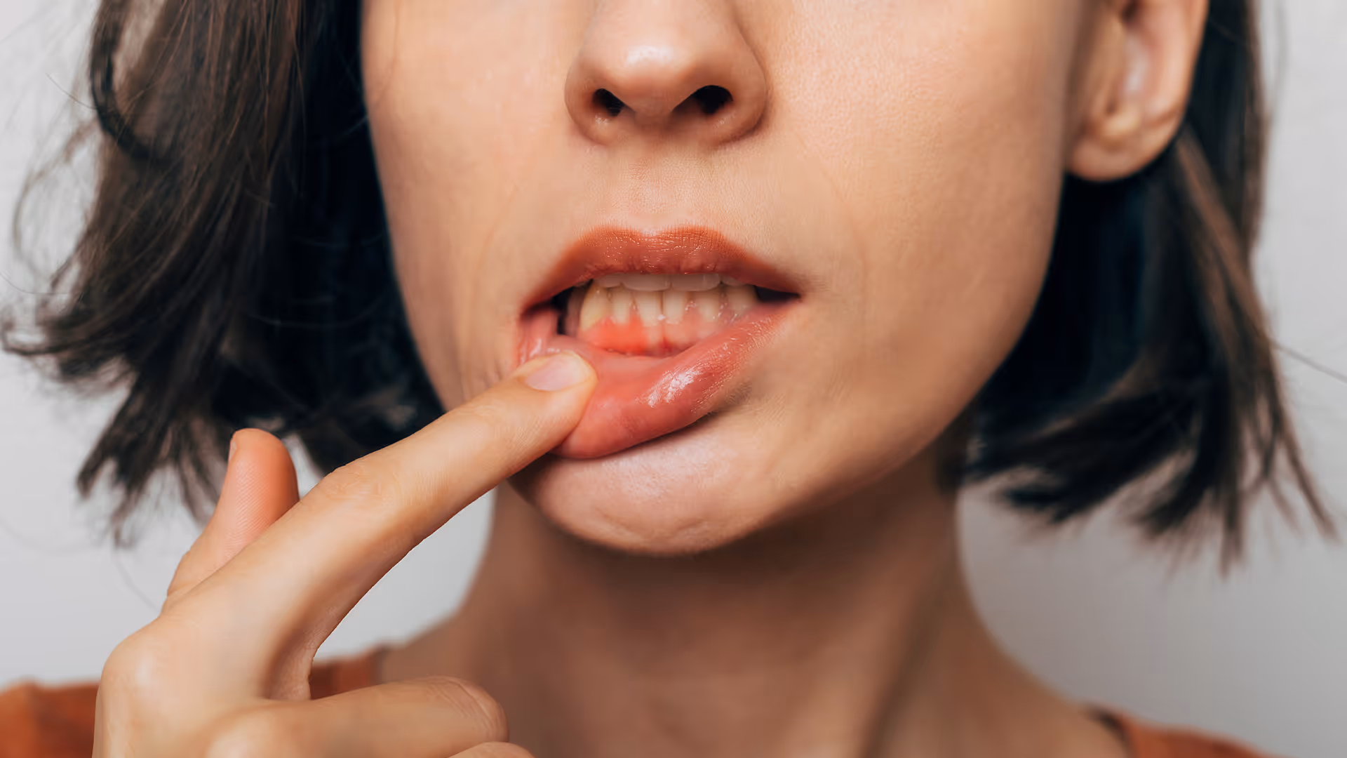 Periodontal disease treatment in Clifton NJ showing gum care and deep cleaning procedure