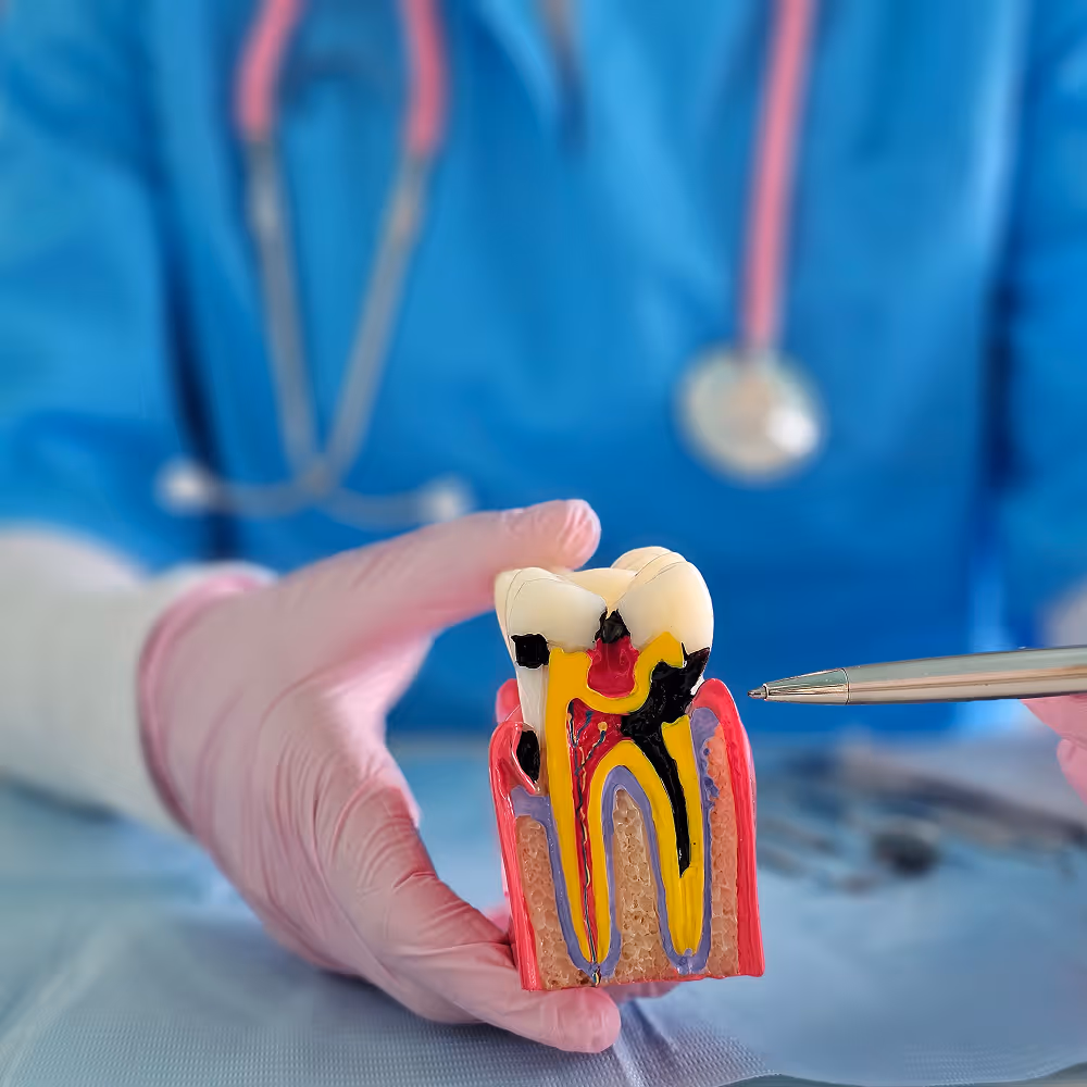 Dentist performing root canal treatment using endodontic tools to clean and seal tooth