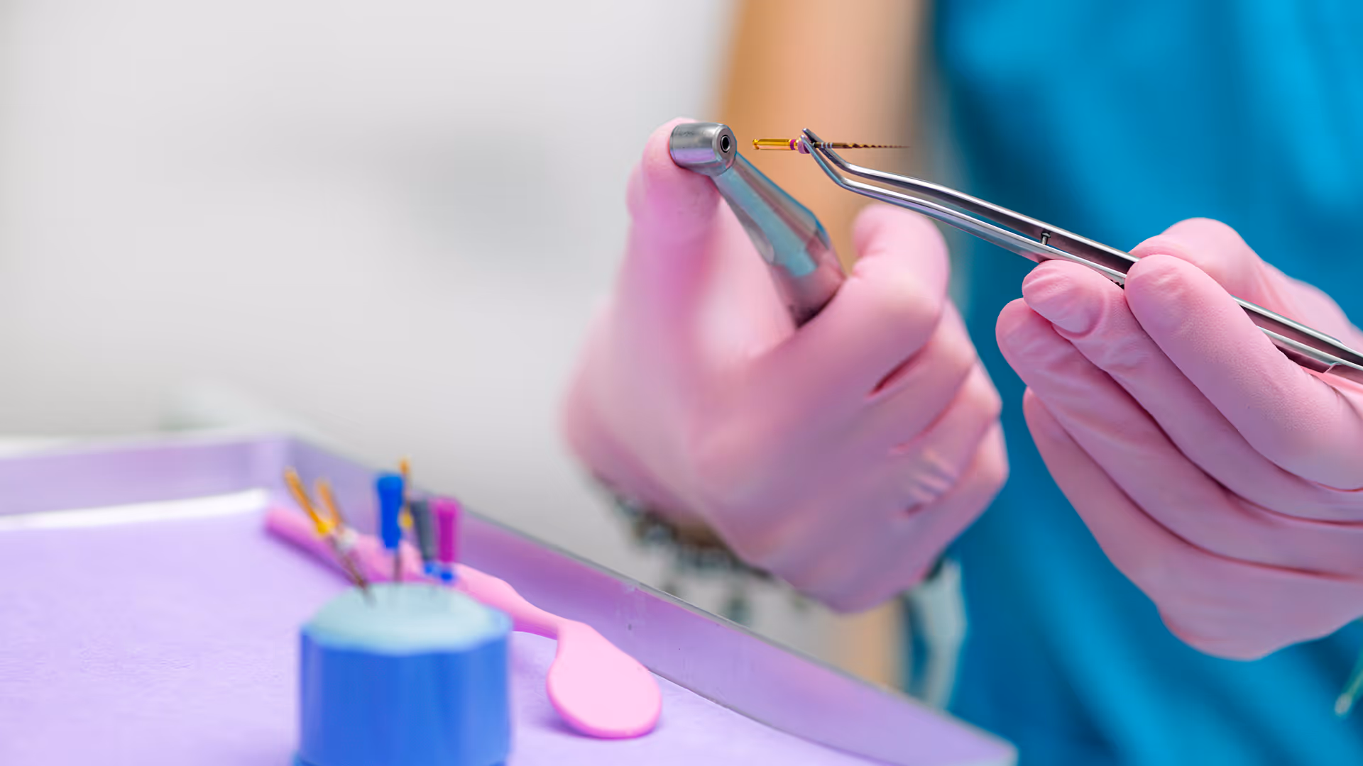 Root canal therapy in Clifton NJ showing dental procedure to remove infected pulp and save tooth