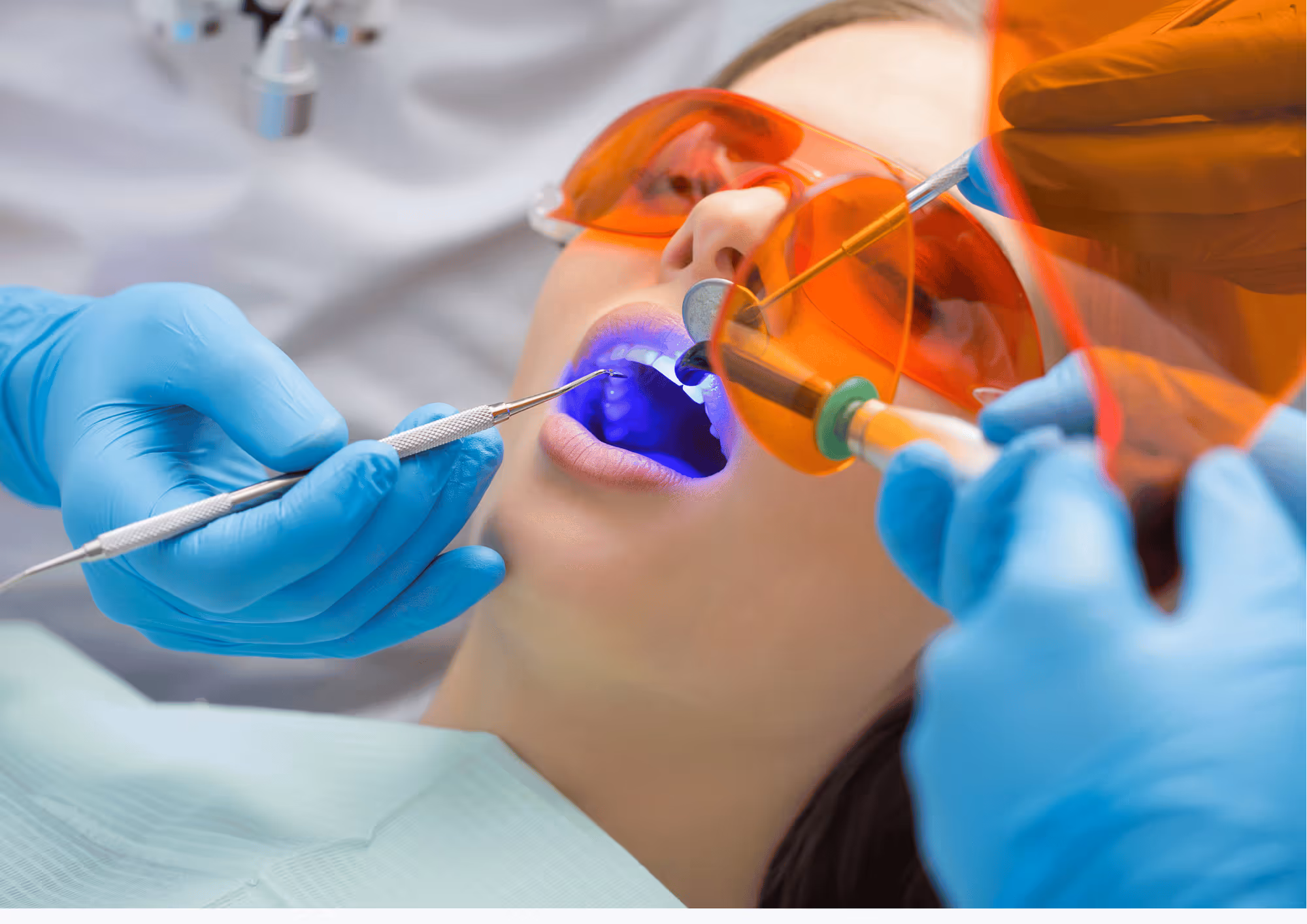 What are dental fillings and how they repair cavities