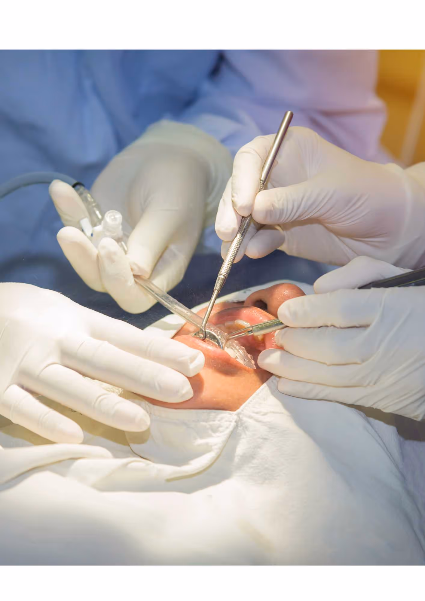What is oral surgery and when it is needed
