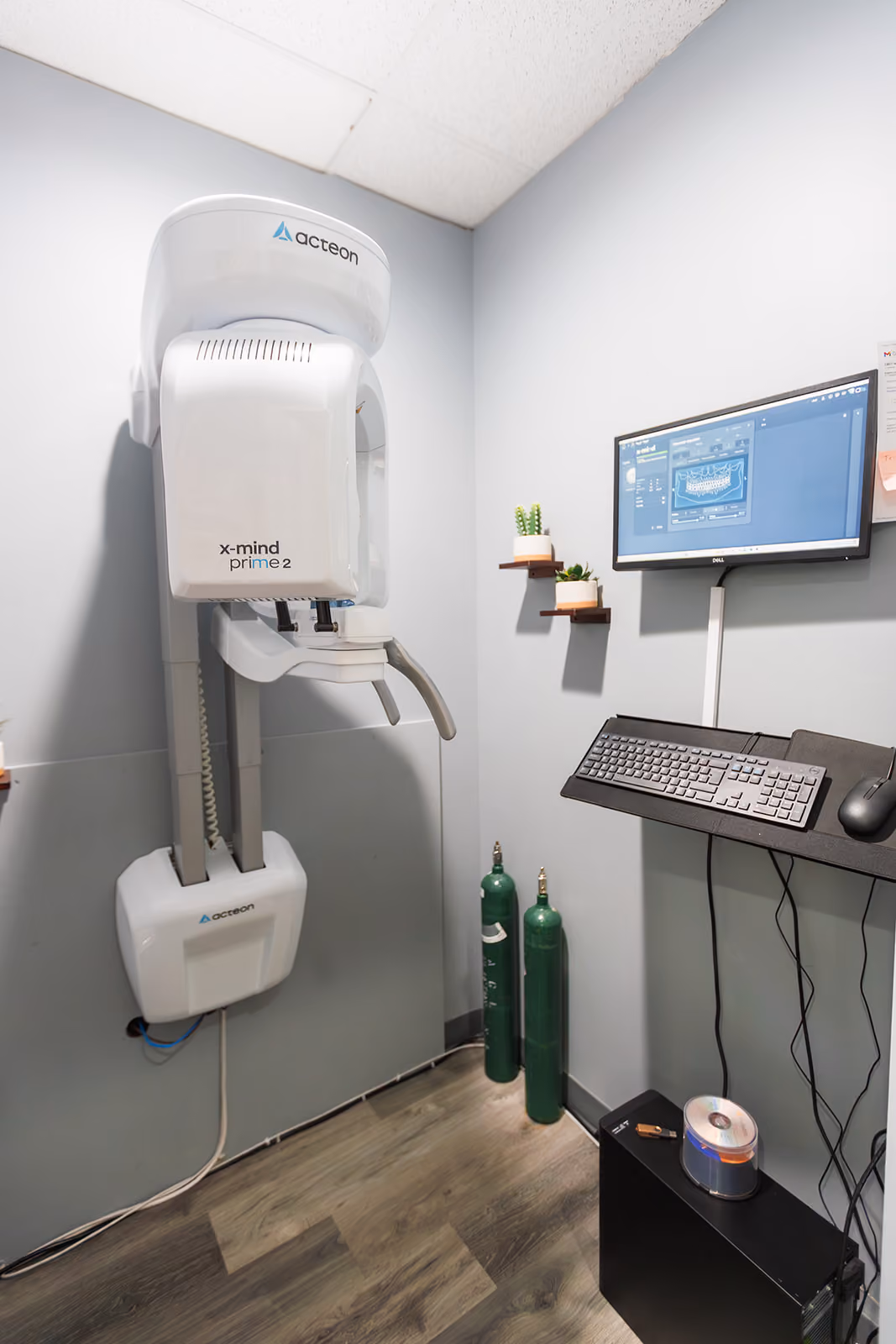 What Are Dental X-Rays