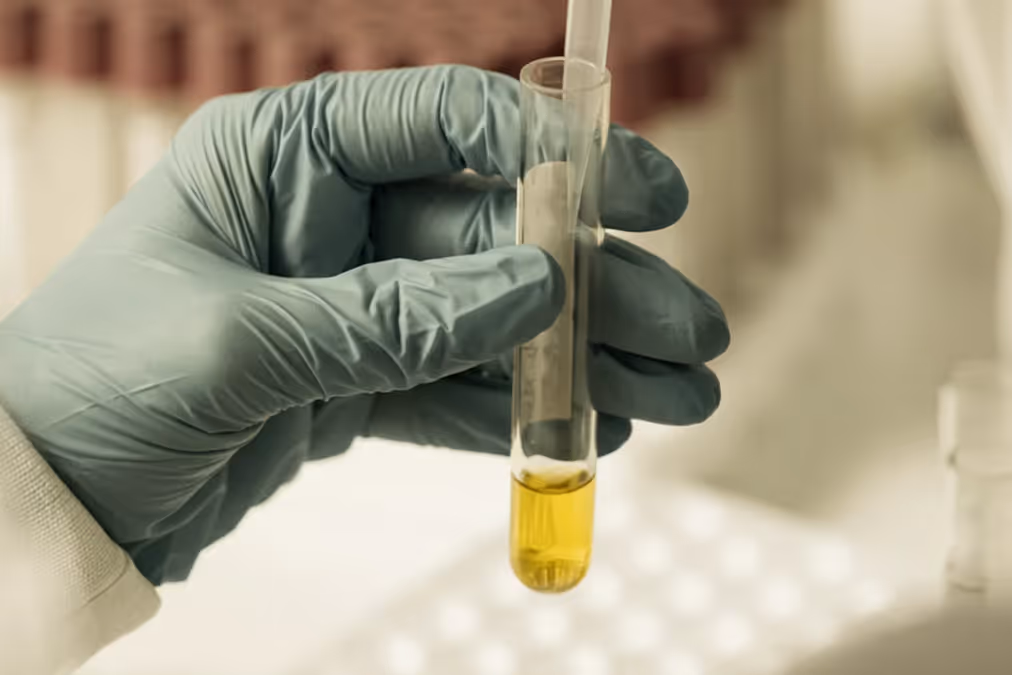 Gloved hand holding a test tube with yellow liquid in a laboratory setting.