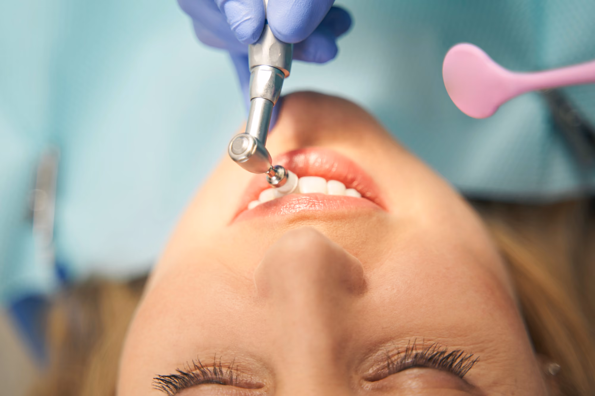 Dental hygienist performing a professional teeth cleaning procedure on a patient.