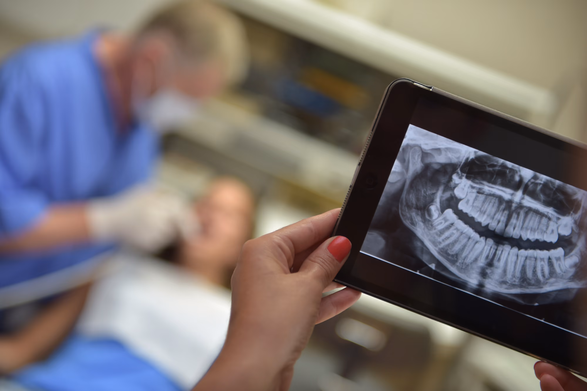 Digital panoramic dental X-ray displayed on a tablet during a patient consultation.