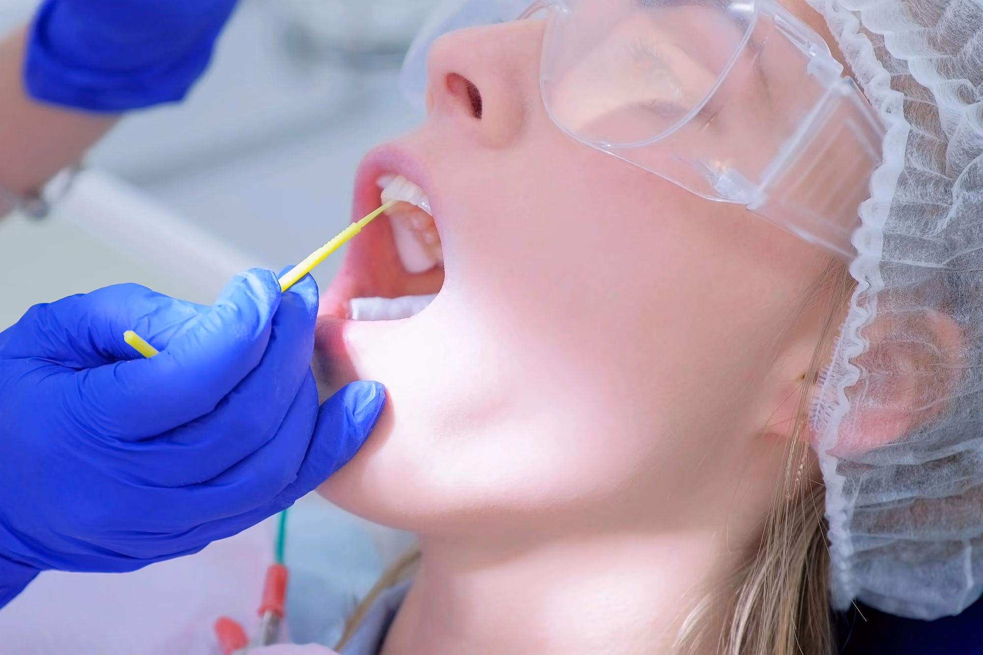 fluoride treatment on a female patient wearing protective glasses.