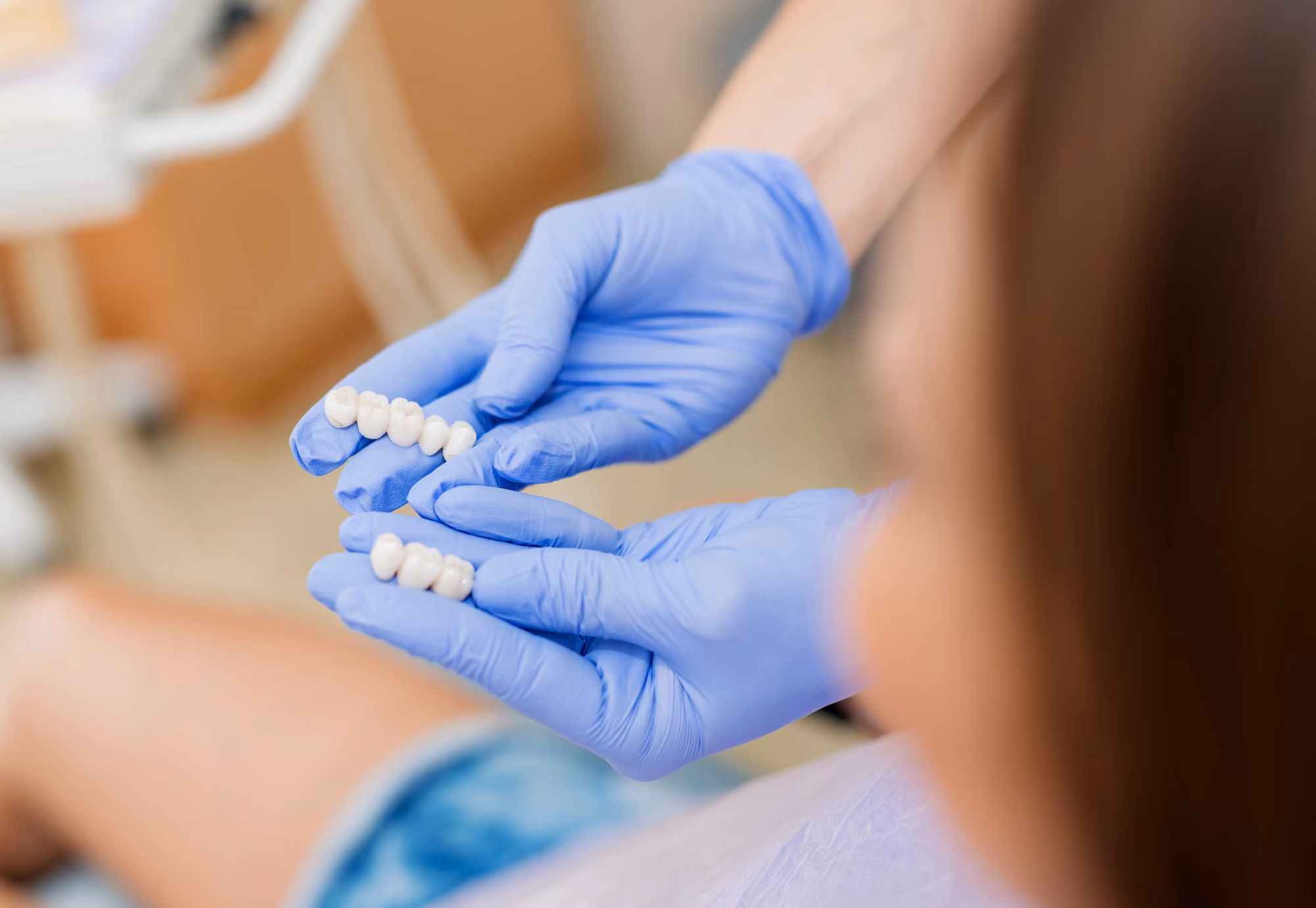 Dental professional holding dental prosthetic teeth components for evaluation or demonstration.