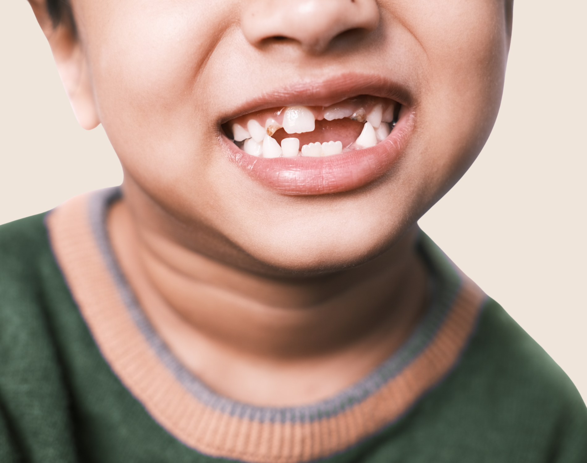 Knocked-out Baby Tooth