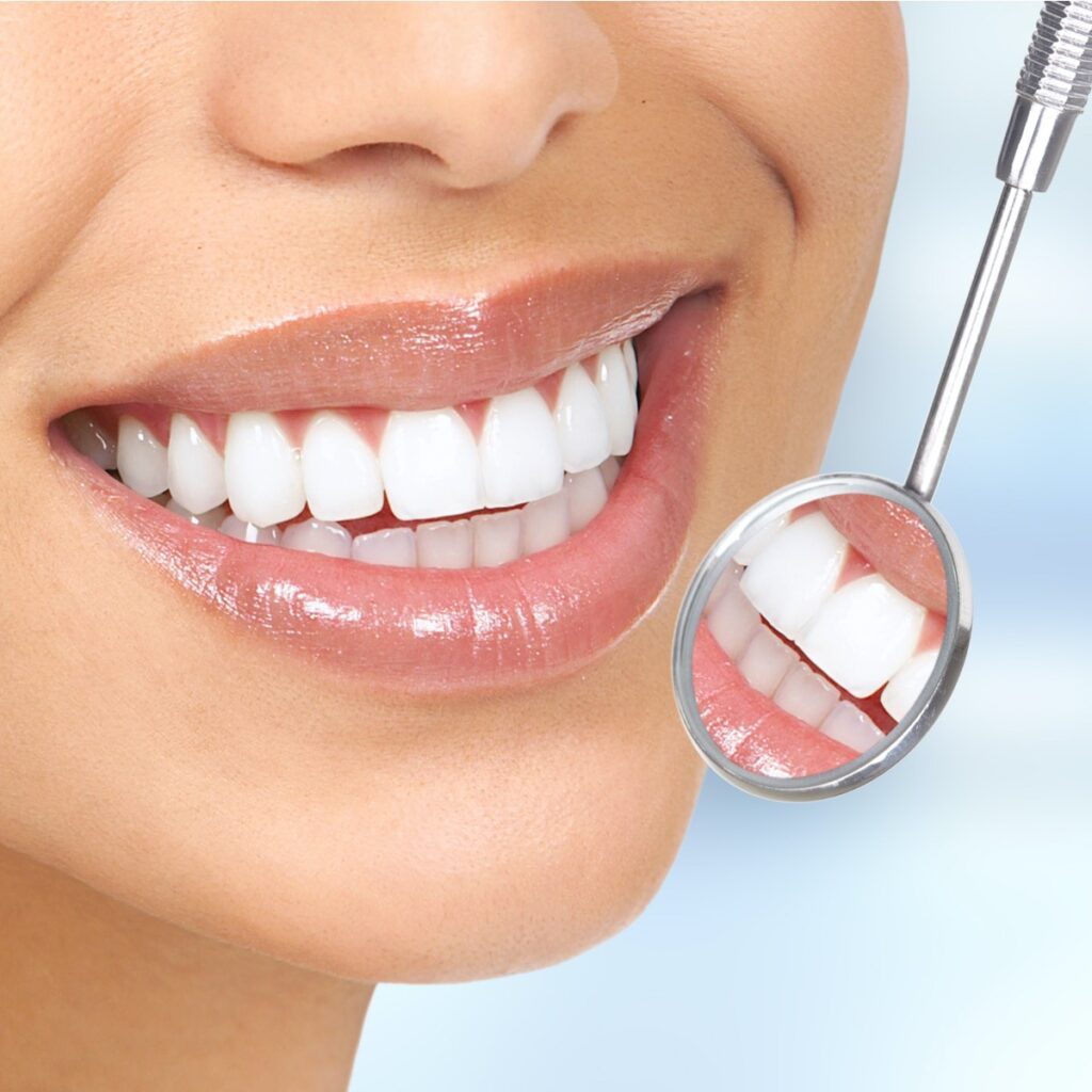 Guided Biofilm Therapy (GBT) Cleaning