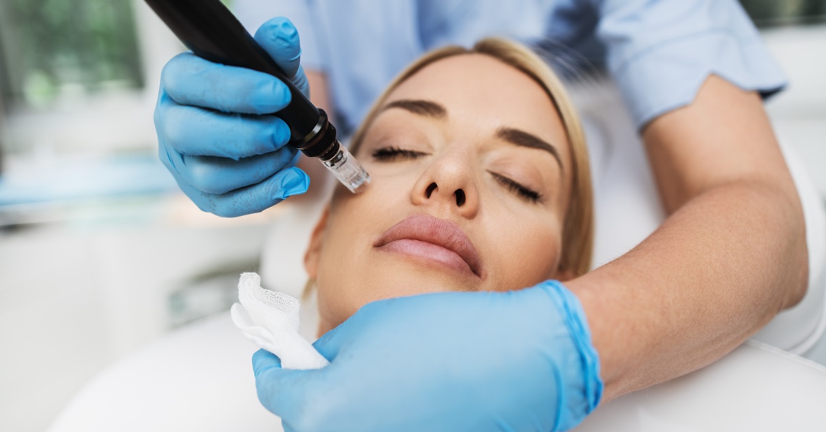 What to Expect After Microneedling: Day-by-Day Guide