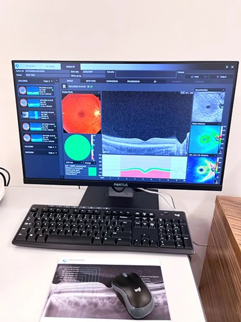 OCT scan results displayed on a computer monitor, showing retinal cross-sections, a fundus photograph, and a retinal thickness map