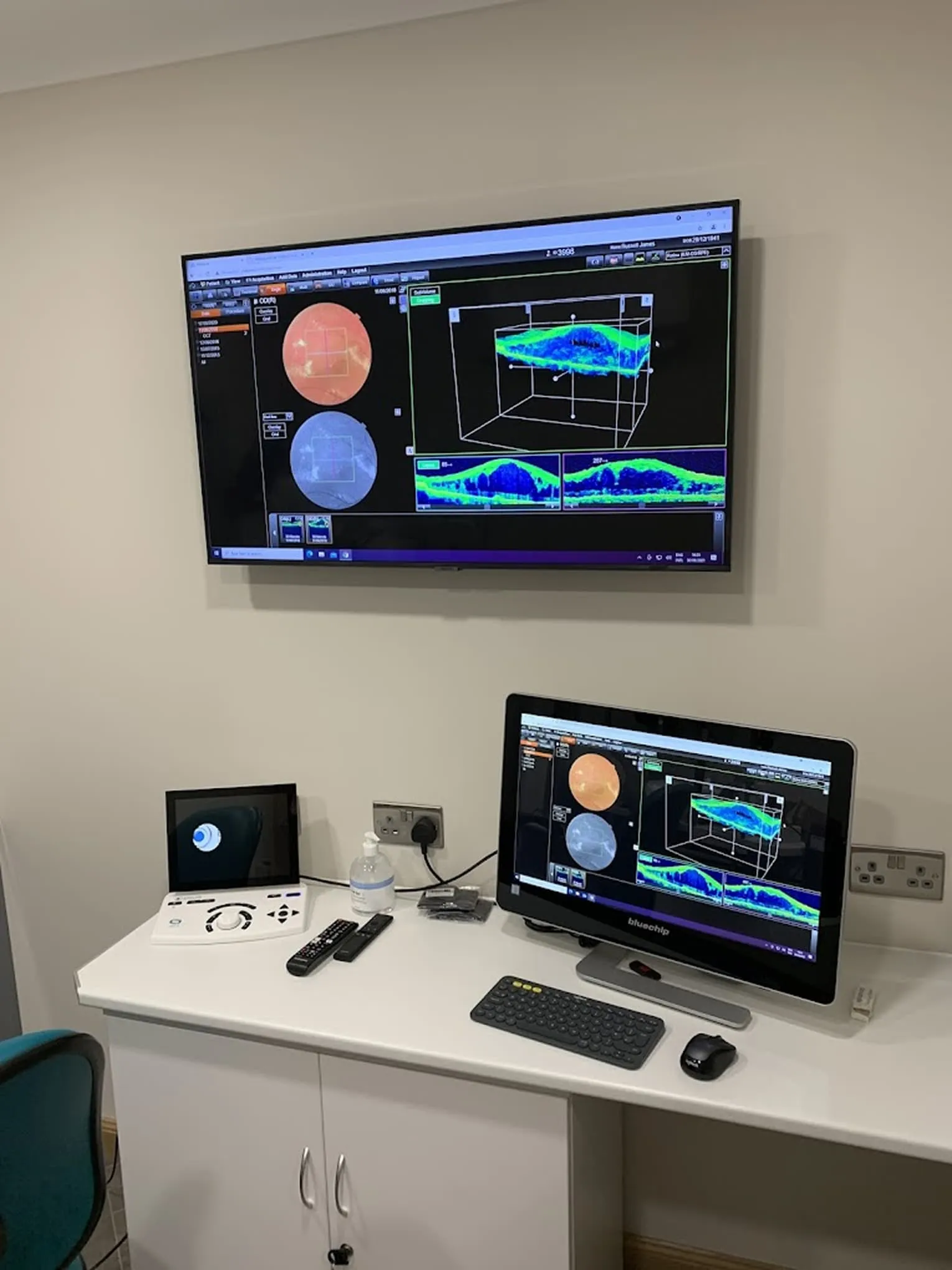 Medical imaging setup showing retina scans on a desktop monitor and wall-mounted TV in a clinical room.