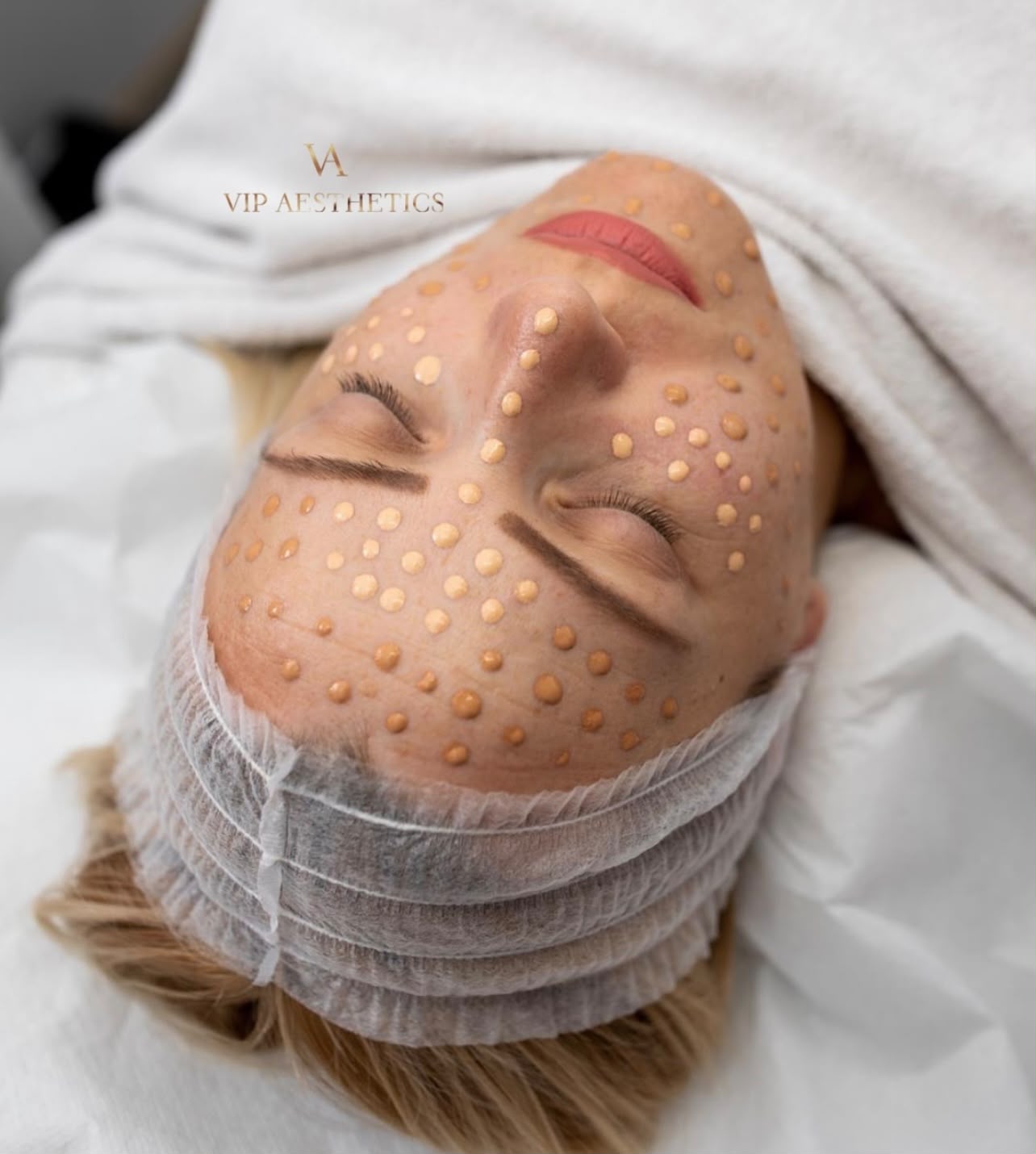 BB Glow Behandlung bei VIP Ästhetics