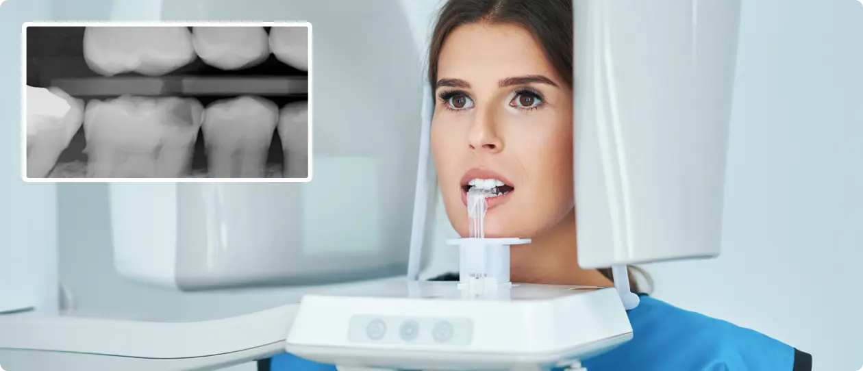 Woman undergoing dental X-ray with bite sensor in mouth, inset shows black-and-white molar teeth X-ray image.