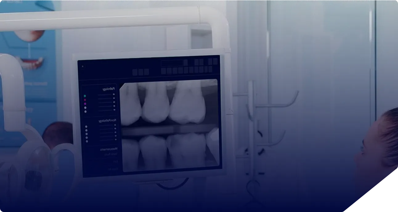 Dental X-ray image displayed on a monitor showing molars in a dental clinic.