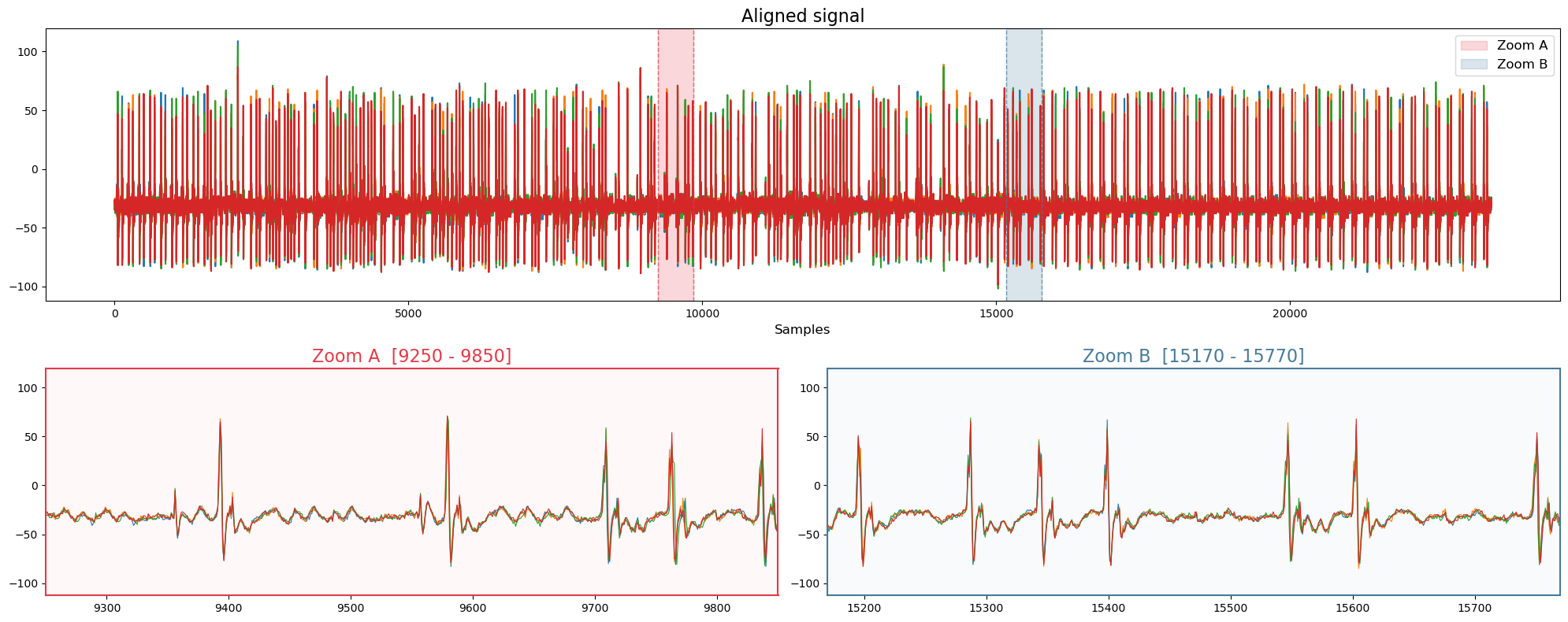 EM signal after per-peak alignment, zoomed windows now overlapping.