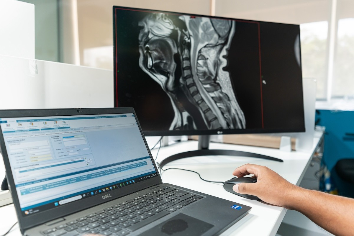 Persona utilizando un mouse y una computadora, con una resonancia magnética de la columna cervical mostrada en un monitor.