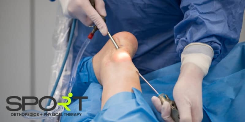 achilles tendinitis surgery