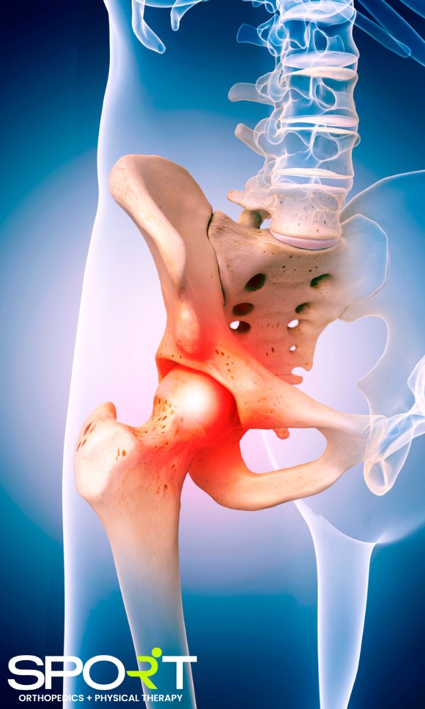 hip arthroscopy dallas