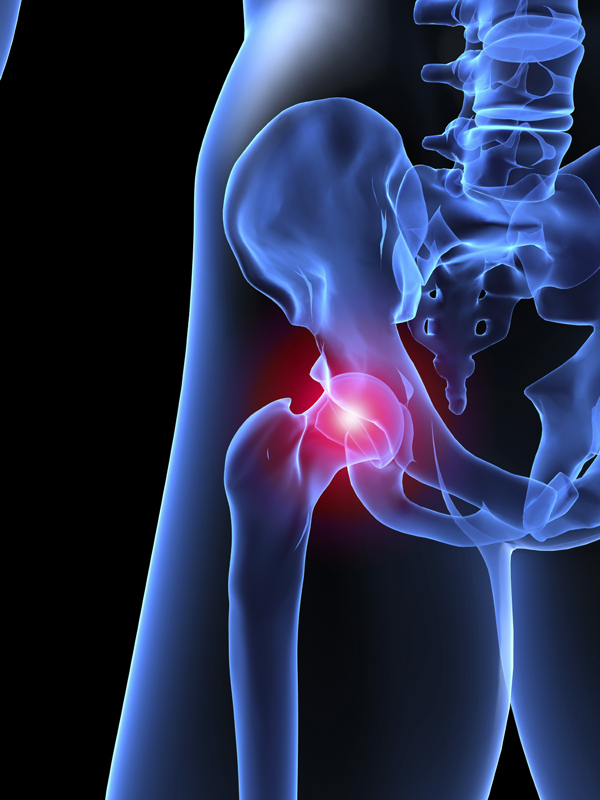 hip labral tear surgery