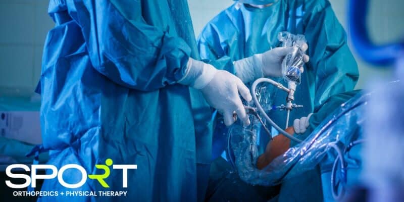 knee arthroscopy frisco