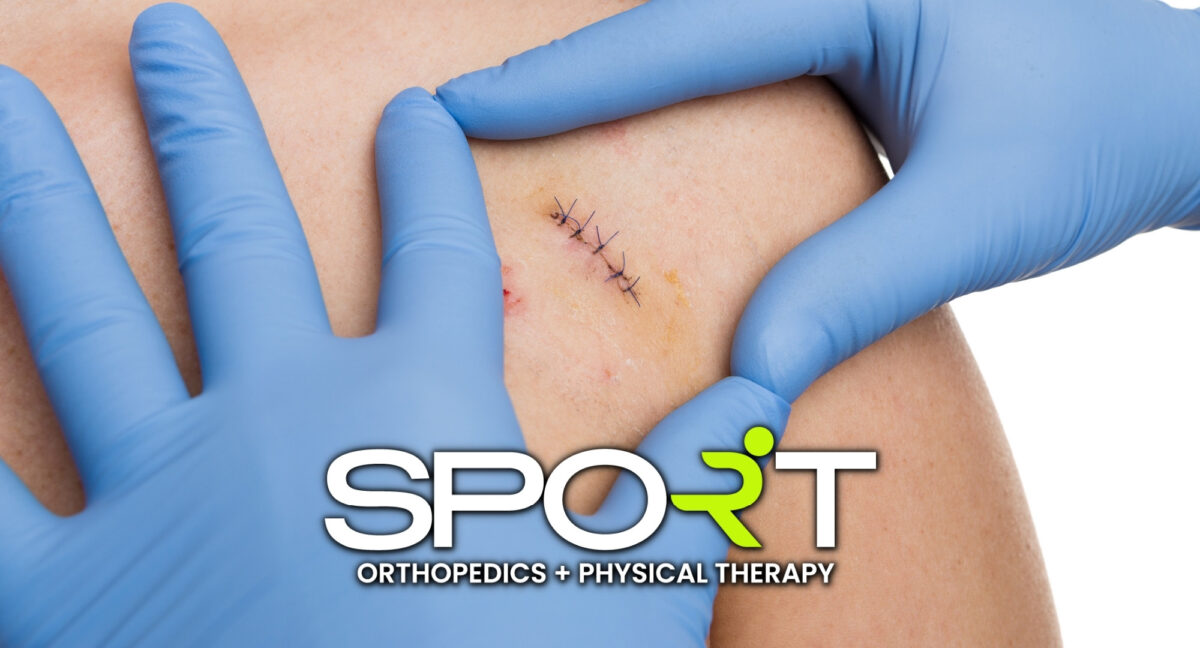 arthroscopic shoulder surgery