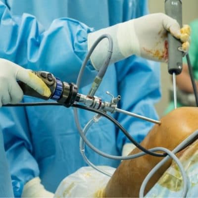 shoulder arthroscopy