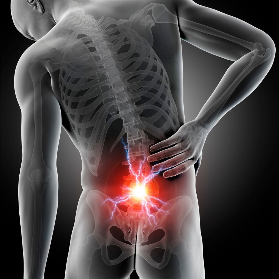 cervical stenosis symptoms