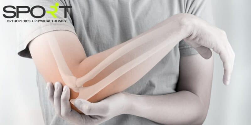 what causes bursitis