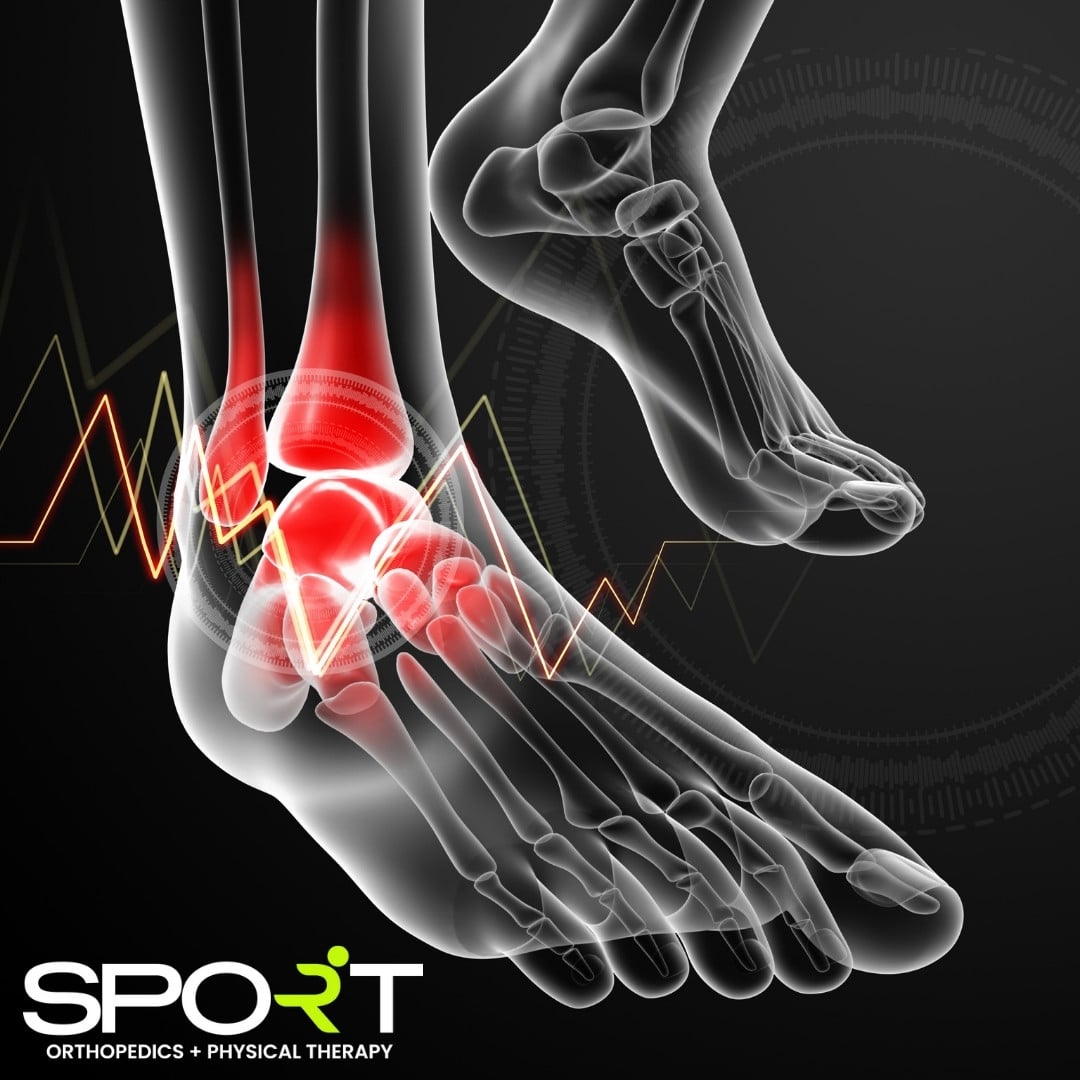 osteochondral lesions
