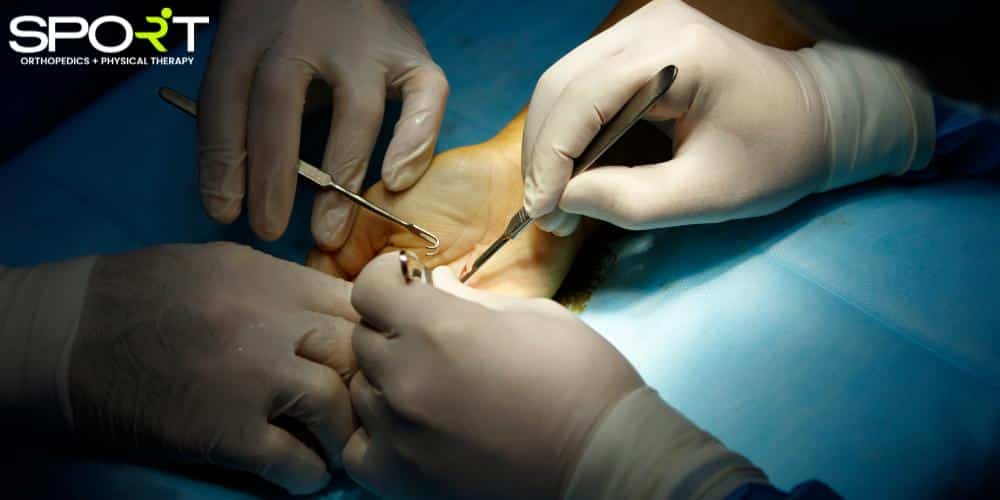 tfcc tear surgery dallas tx