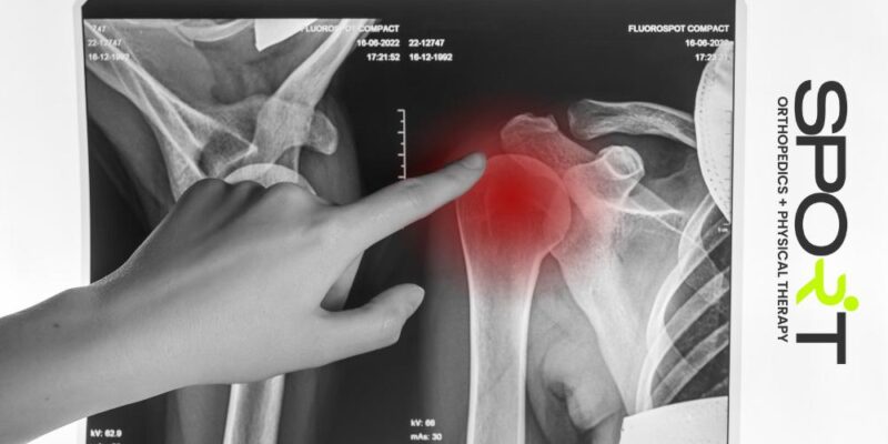 torn rotator cuff dallas