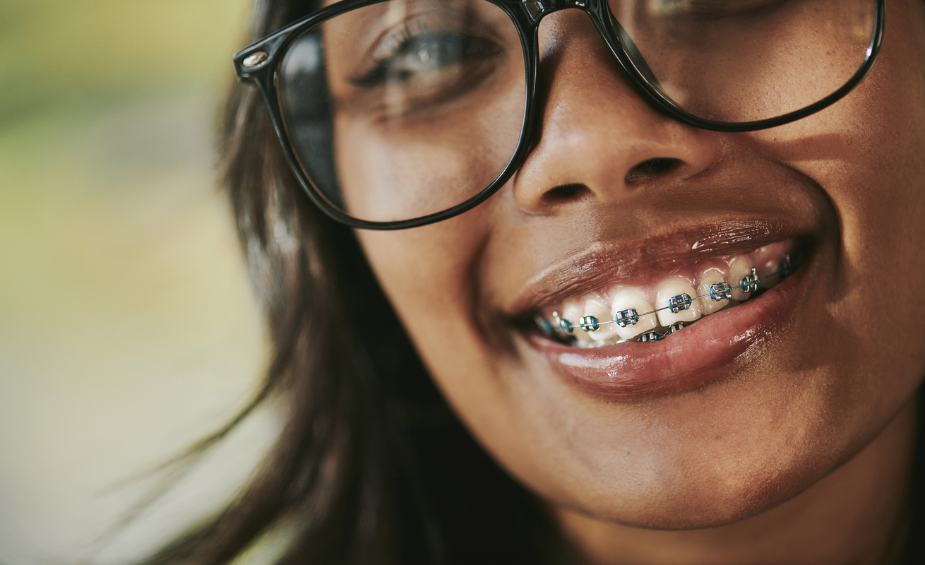 Can Braces Cause TMJ Disorder? What the Evidence Says