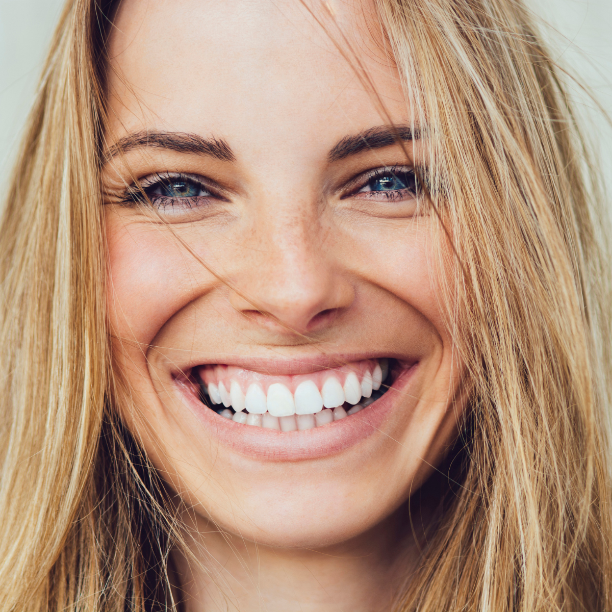 What Porcelain Veneers Can Actually Transform About Your Smile