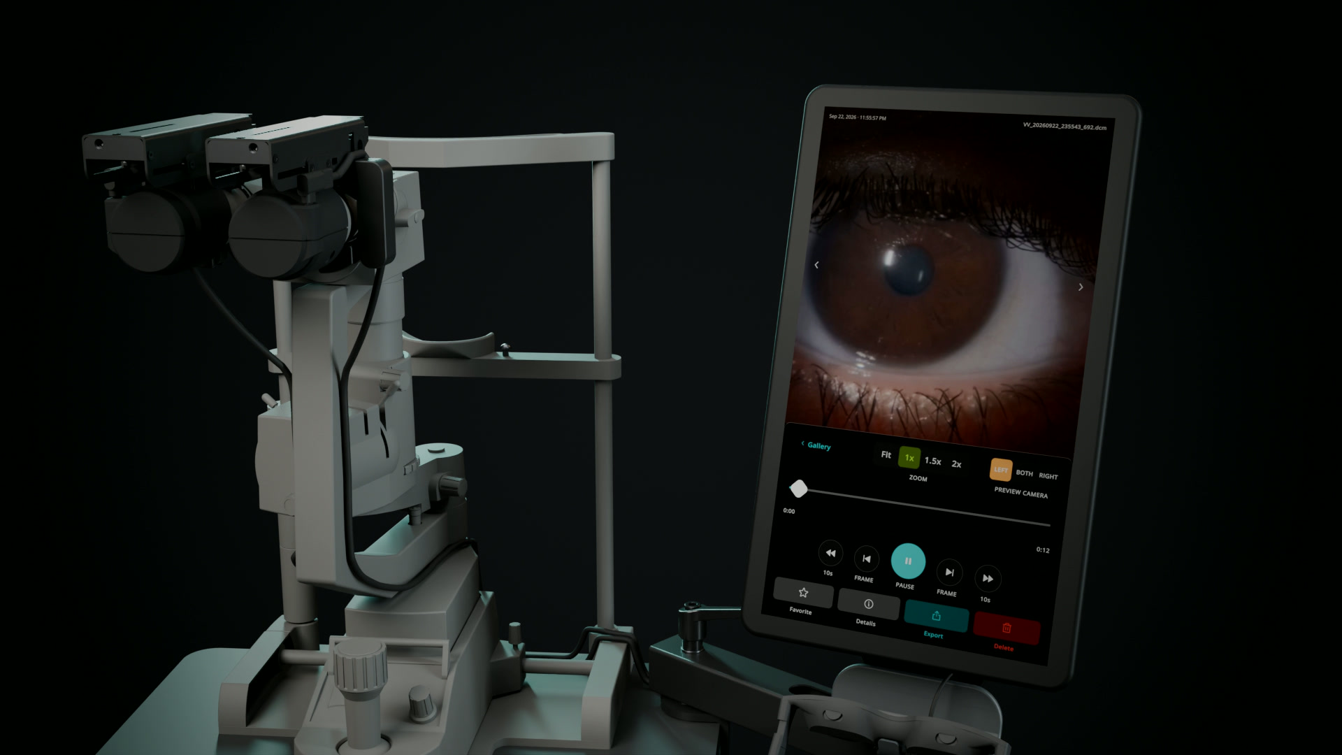 CAD render of the SVS on a slit lamp, with the touchscreen terminal open to a saved image in the recorded review screen.