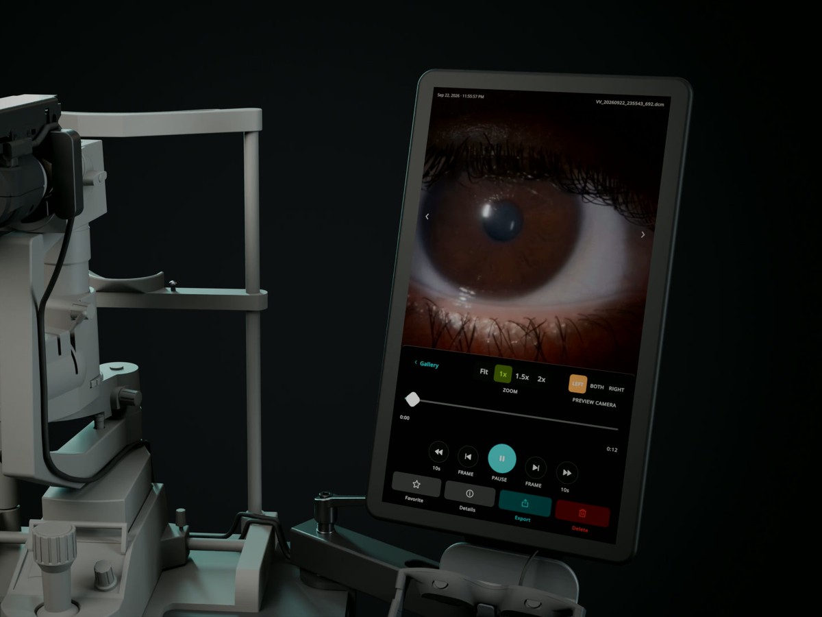 The VitaPixel SVS on a slit lamp, with the touchscreen open to a saved eye image for review.