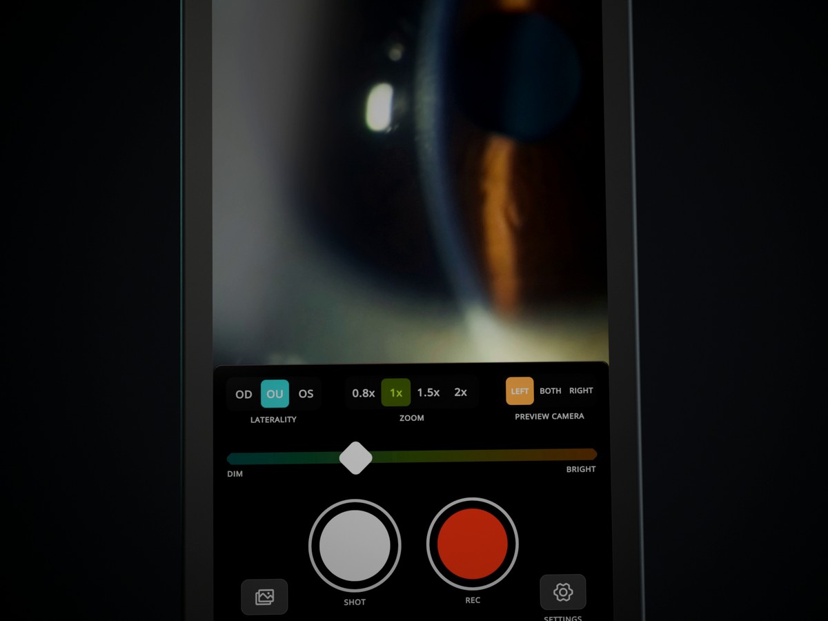 The VitaPixel SVS touchscreen showing the capture screen: a live slit lamp view with shot and record controls.
