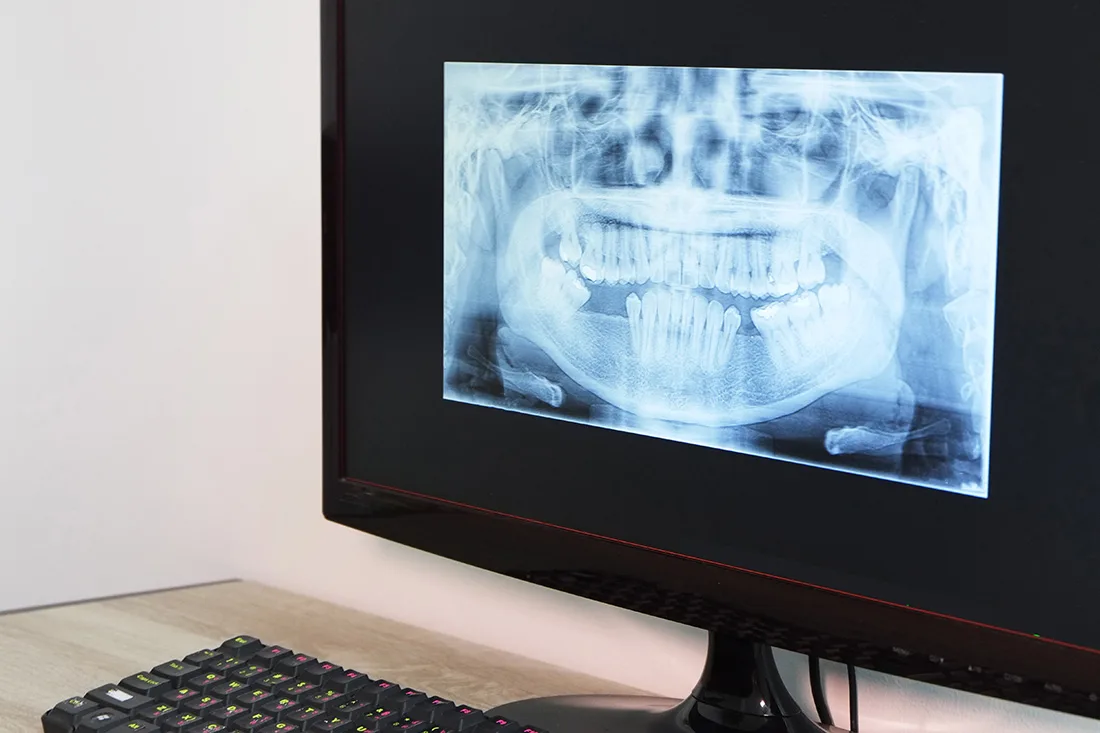 Digital X-Ray Images
