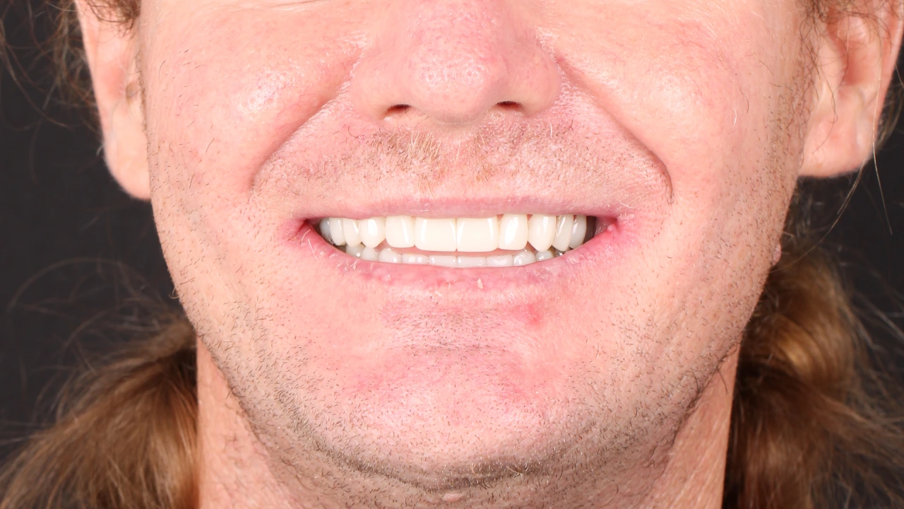 After Image