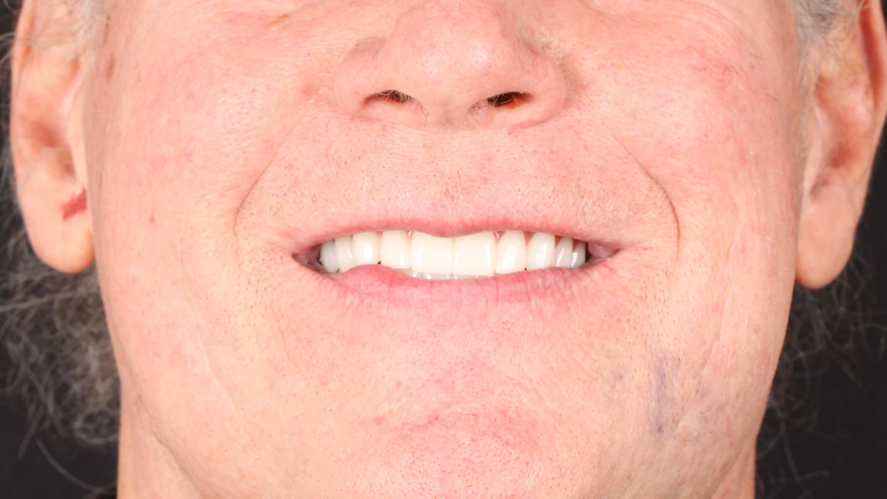 After Image