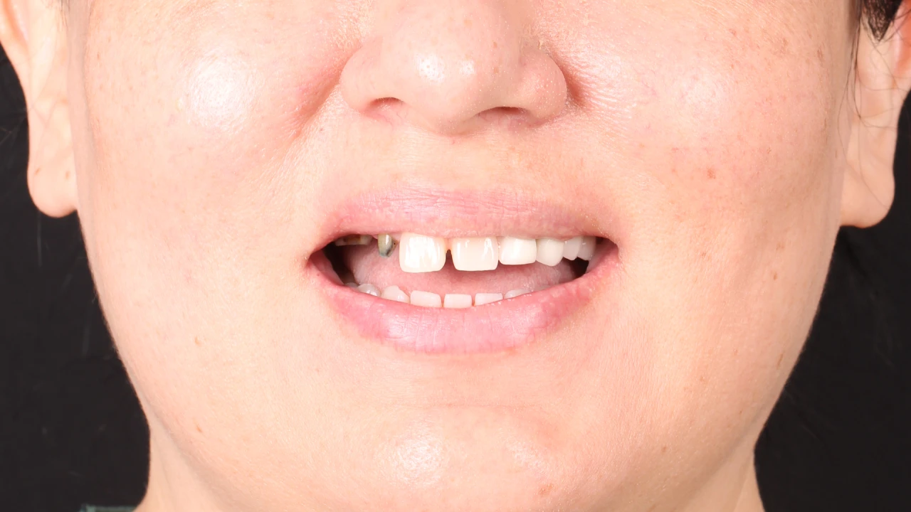 Before Image