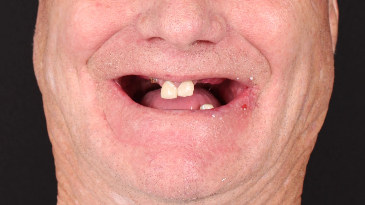 Before Image
